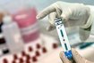 В Харьковских наркологических поликлиниках появился врач-нарколог,  который может проводить быстрые тесты на ВИЧ