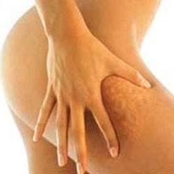 Ультра звуковая кавитация = безоперационная липосакция 